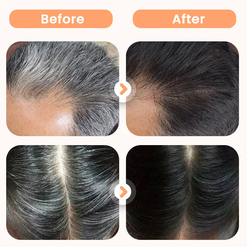 Plant Extract Hair Dye for Gray Hair Plant Extract Hair Dye for Gray Hair