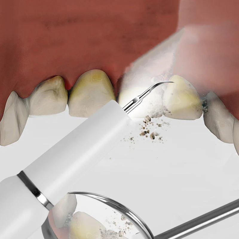 Electric ultrasonic oral irrigator