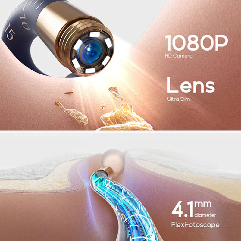 The safest tool for cleaning ears  Visual Arc Ear Wax Removal Kit