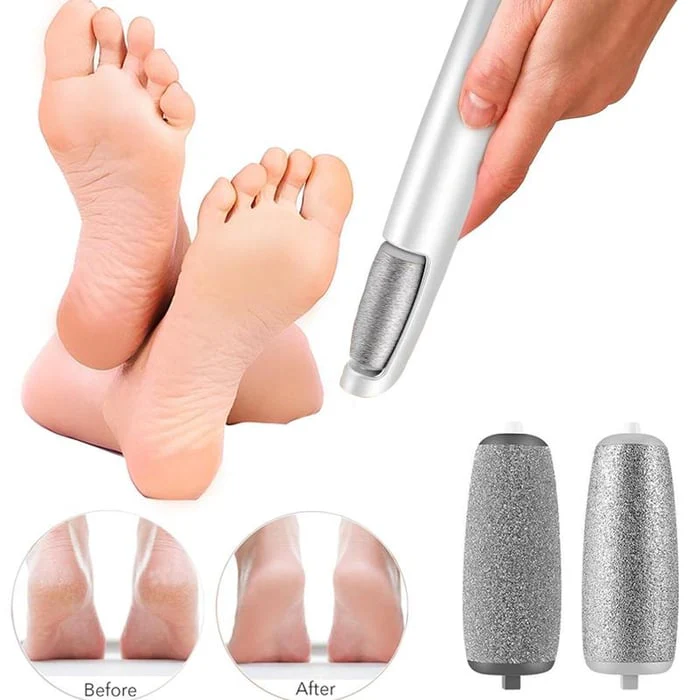 LAST DAY SALE 49% OFFElectric Feet Callus Remover