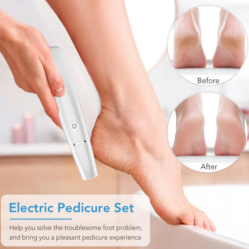 LAST DAY SALE 49% OFFElectric Feet Callu...