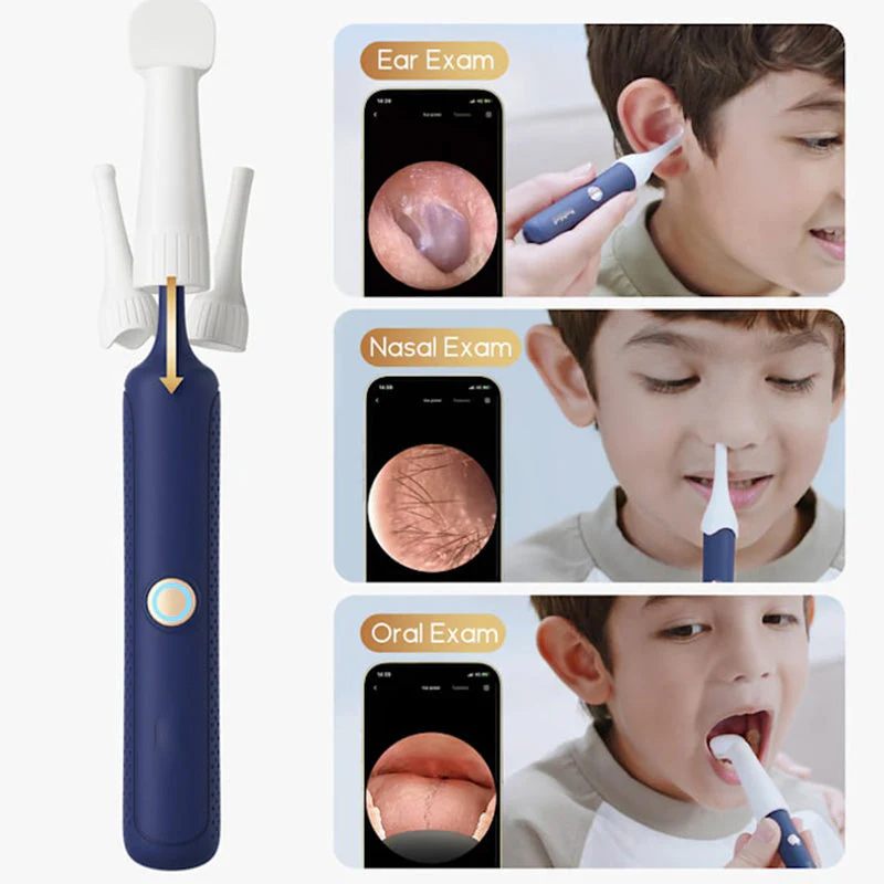 The safest tool for cleaning ears  Visual Arc Ear Wax Removal Kit