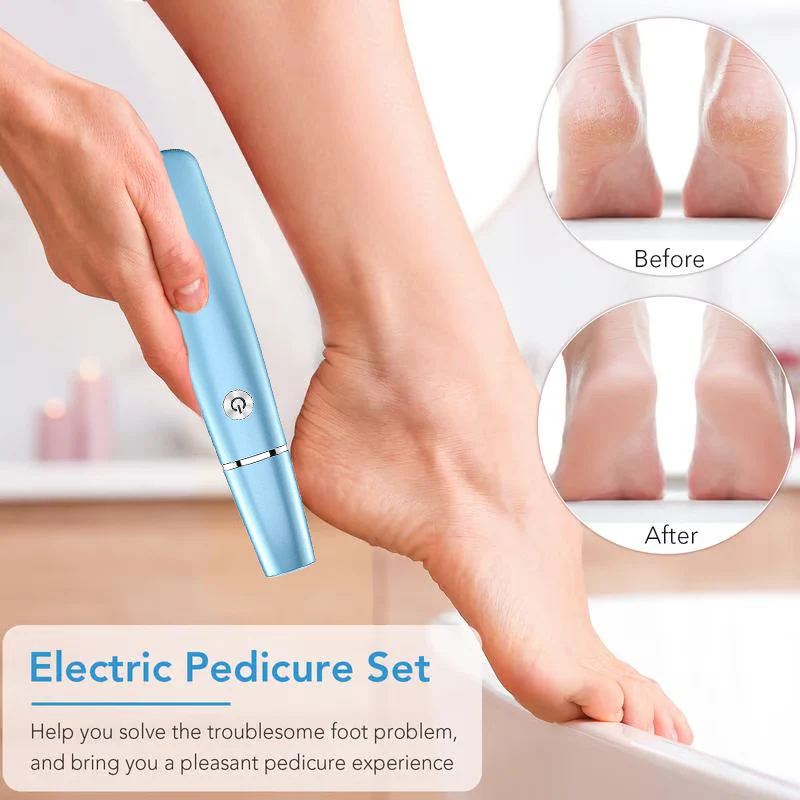 LAST DAY SALE 49% OFFElectric Feet Callus Remover