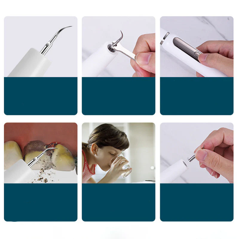 Electric ultrasonic oral irrigator