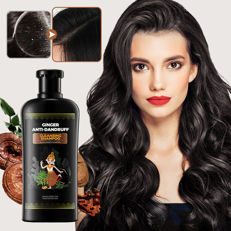 2025 Hot Sale 49% OFFGinger Anti-Dandruf...