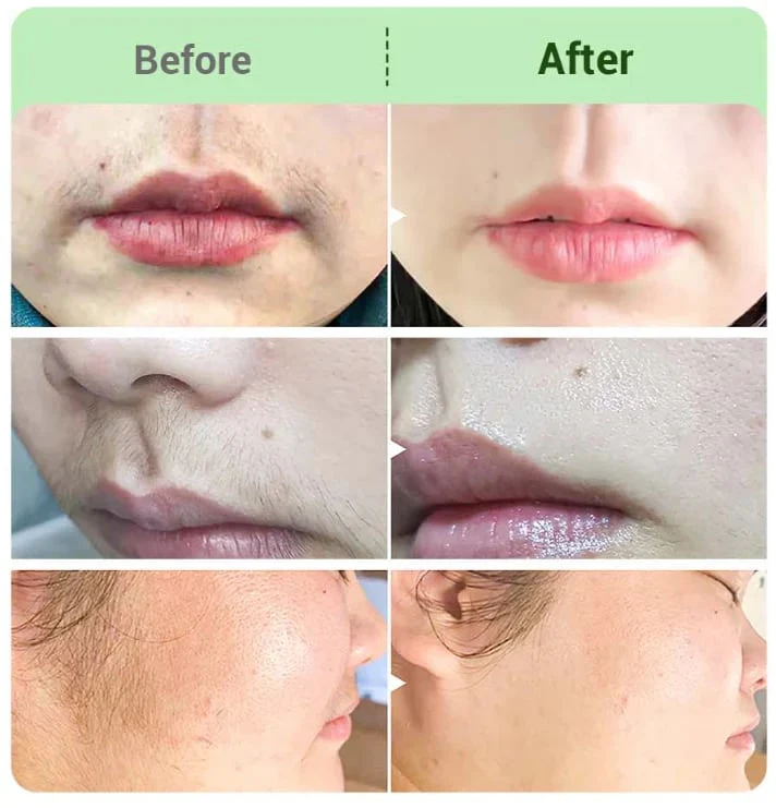 BUY 2 GET 1 FREEHair Removal Cream Kit for Women