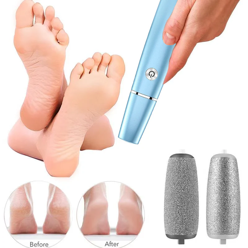 LAST DAY SALE 49% OFFElectric Feet Callus Remover
