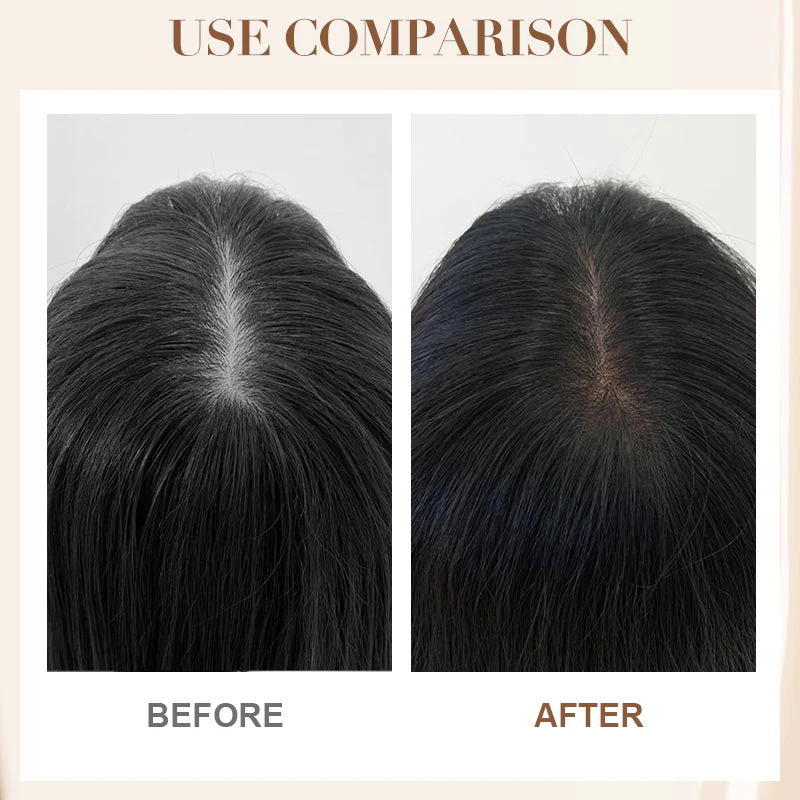 Anti-Hair Loss Strengthening Shampoo Anti-Hair Loss Strengthening Shampoo