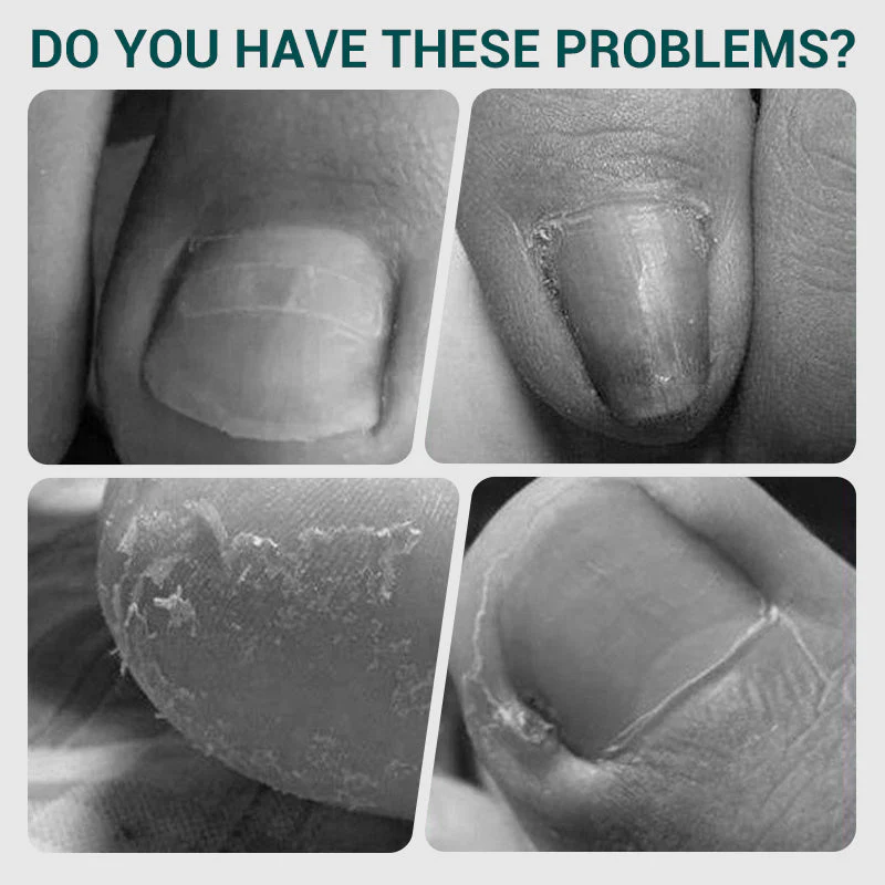 2025 Hot Sale Pro Angled Spring Nail Clipper