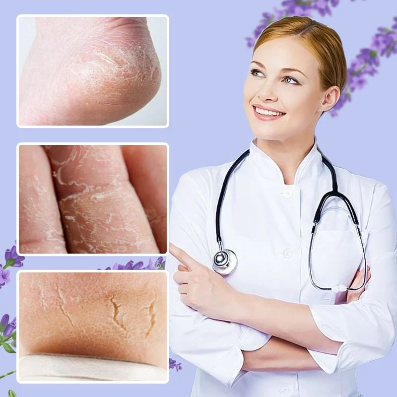 Nourishing and repairing dry and cracked skin  Look 20 years younger in an instant  Limited time 77% off  Come and give your feet a fresh new look!