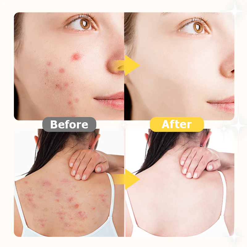 Antibacterial & Anti-Mite Mugwort Herbal Soap