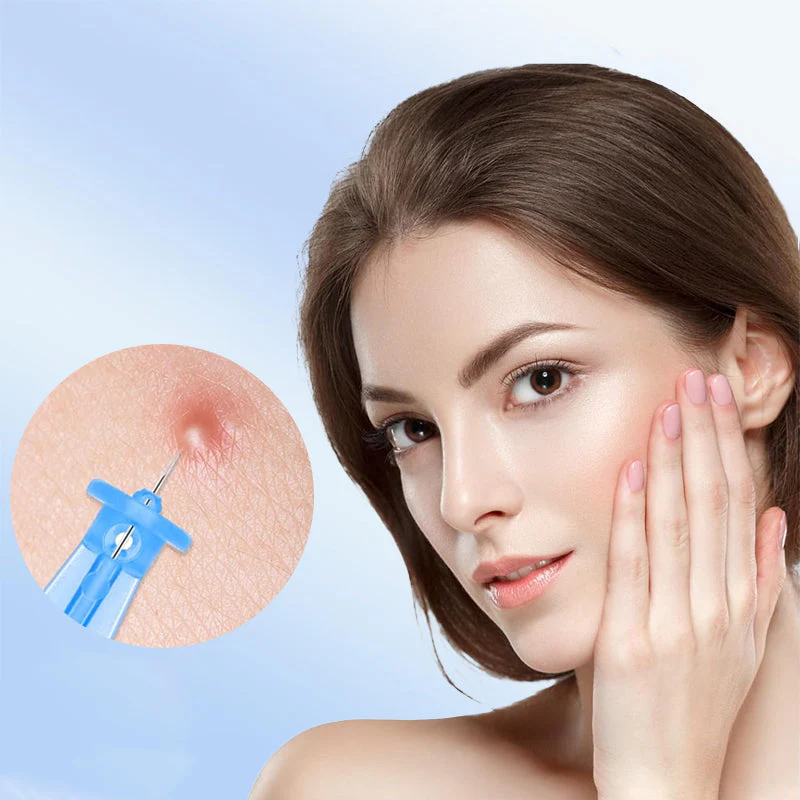 Disposable Sterile Pimple Needles