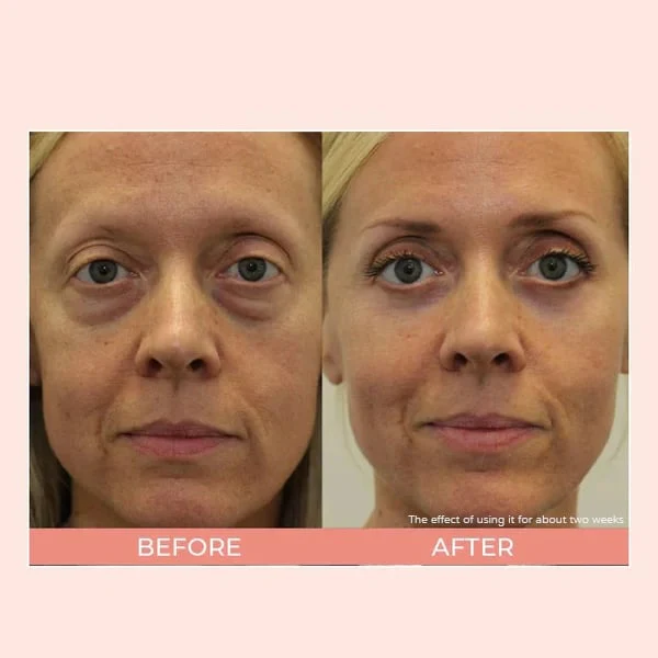  2025 New Hot Sales - 50% OFFLuminous Eye Corrector SPF 41