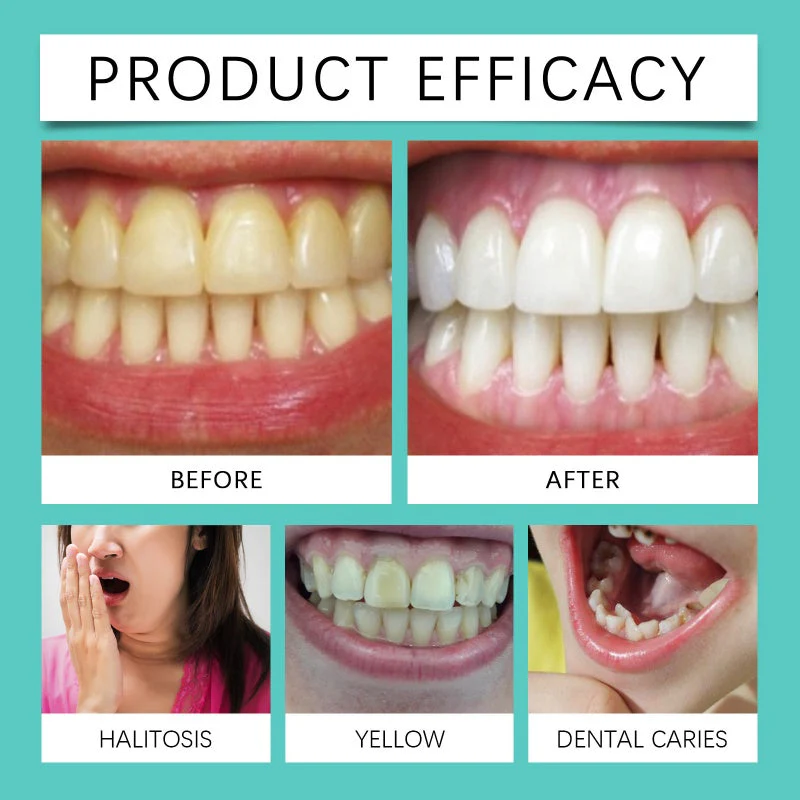 Enamel-Safe Teeth Whitening Strips