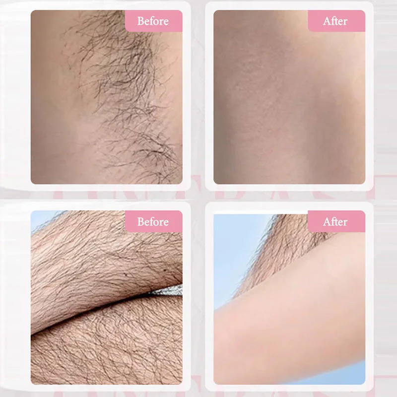 Spring Hot SaleGentle & Effective Hair Removal Cream Spring Hot SaleGentle & Effective Hair Removal Cream