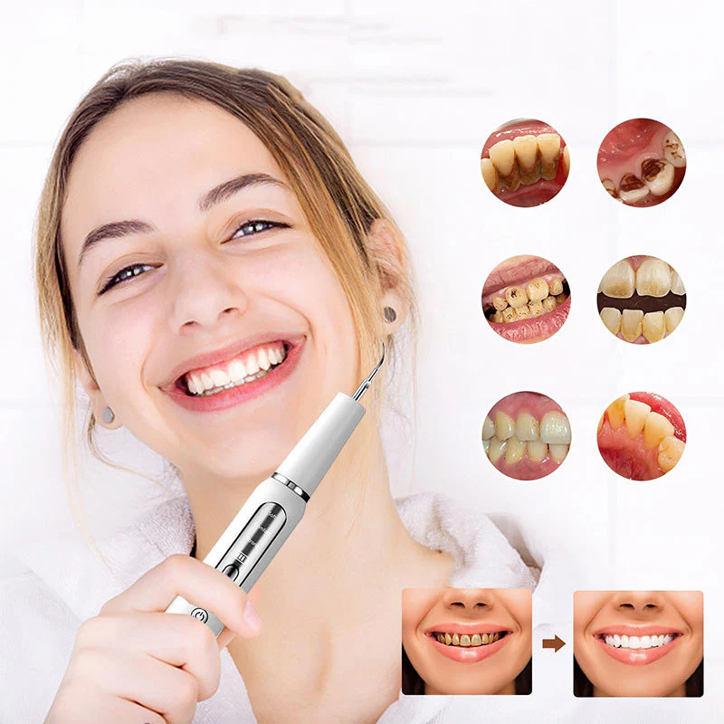 Electric ultrasonic oral irrigator