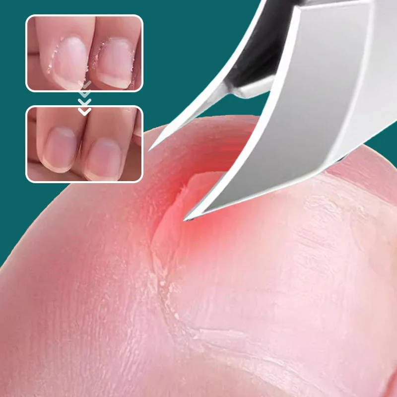  Anti-Splash 25° Slant Edge Nail Clipper 3-Piece Set