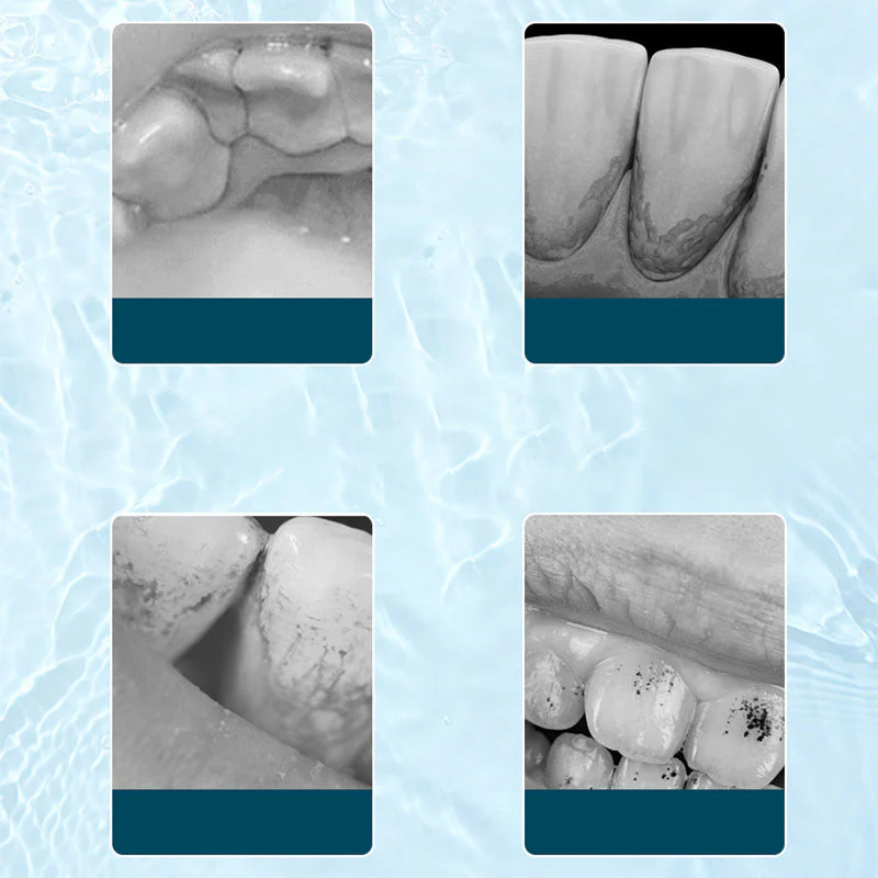 Electric ultrasonic oral irrigator