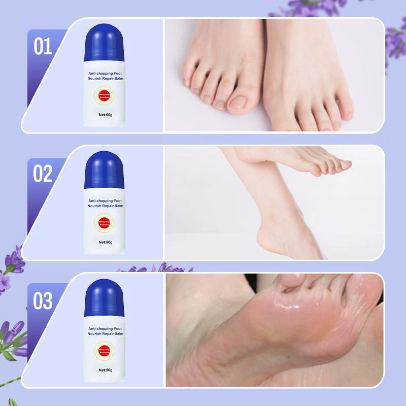 Nourishing and repairing dry and cracked skin  Look 20 years younger in an instant  Limited time 77% off  Come and give your feet a fresh new look!