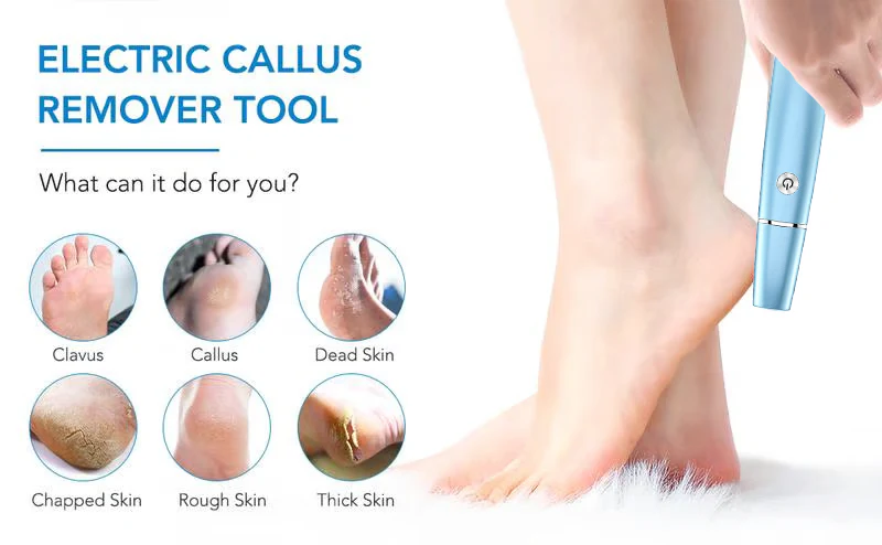 LAST DAY SALE 49% OFFElectric Feet Callus Remover